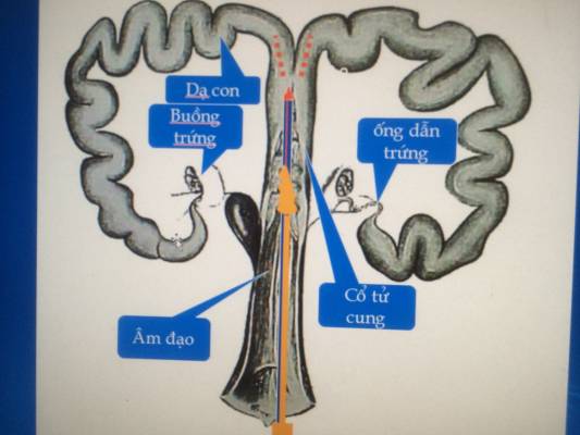 thụ tinh tử cung