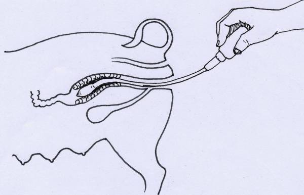 Thụ tinh nhân tạo cho lợn