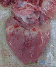 Mỡ vành tim xuất huyết