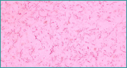 Vi khuẩn Haemophilus parasuis gây bệnh glasser