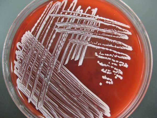 Staphylococcus hyicus trong phòng thí nghiệm (ảnh internet).