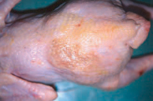 Viêm mô tế bào – da viêm và thoái hóa mảng màu nâu do nhiễm bệnh Ecoli trên gà.