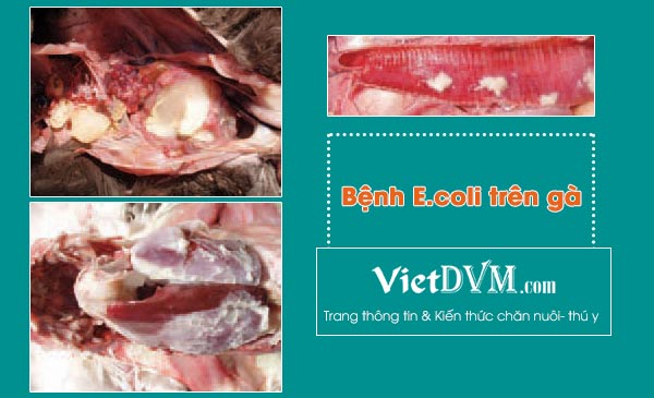 Ecoli gây nhiễm trùng huyết có nguồn gốc từ đường hô hấp