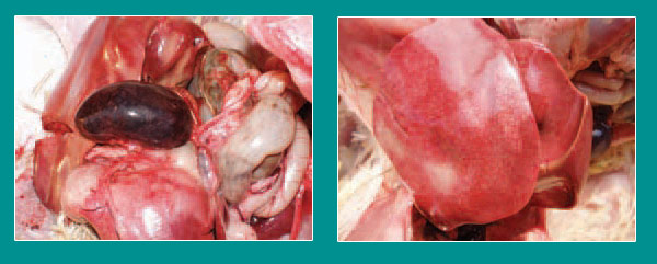 Ecoli nhiễm trùng huyết thứ phát do viêm ruột