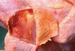 Bên dưới lớp da bị viêm thường tìm thấy các mảng fibrin.