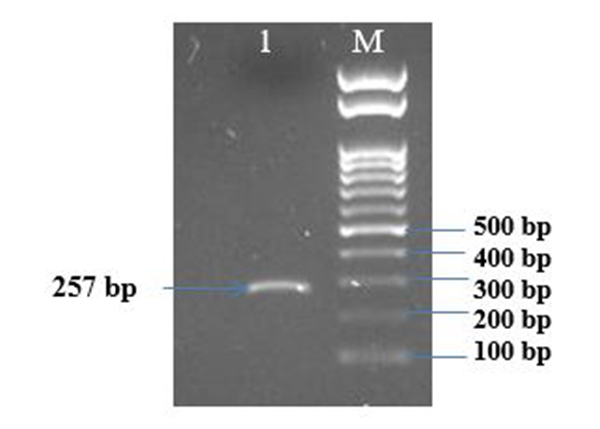 Kết quả chạy điện di trên gel Agarose