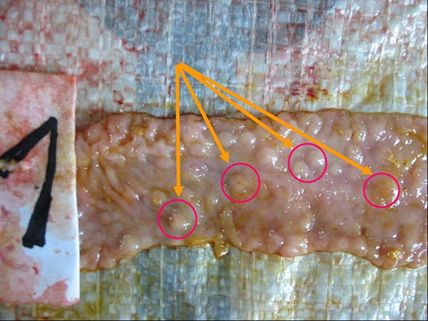 Ruột heo mắc bệnh B.Coli