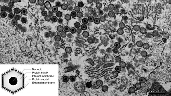 Hình ảnh qua kính hiển vi điện tử của tế bào heo bị nhiễm virus ASF