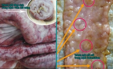 Phân biệt Heo bị tiêu chảy do Bệnh viêm hồi tràng hay do Balantidium Coli gây ra