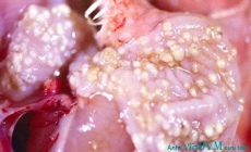 Bệnh nấm diều ở gà (P2) – 4 bước chẩn đoán và nhận diện bệnh nấm diều